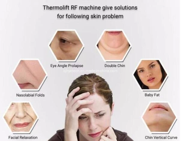 High Quality Thermo Lift Facial RF Lifting Machine Skin Rejuvenation with High Energy