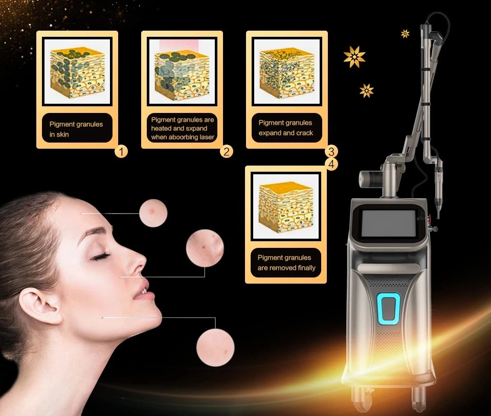 Pico Second Q Switched ND YAG Laser Freckle / Tattoo Removal Picosecond